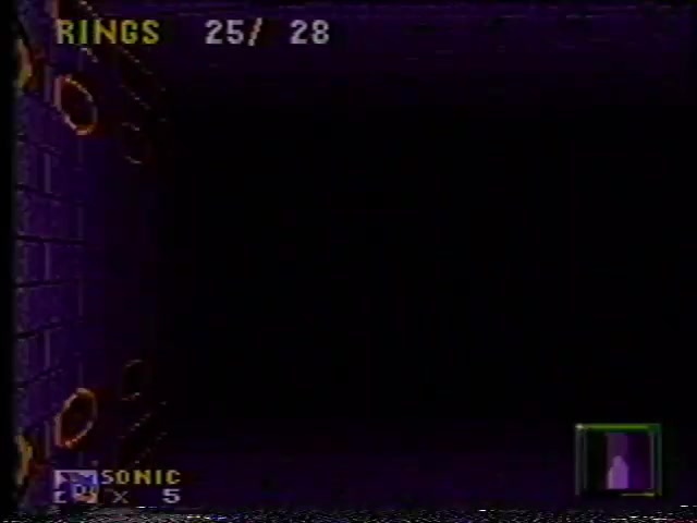 Genesis_1994-09-31_17-45-34 (PTMZD (Post-Traumatic Marble Zone Disorder))
